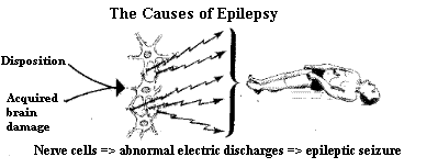 The auses of Epilepsy